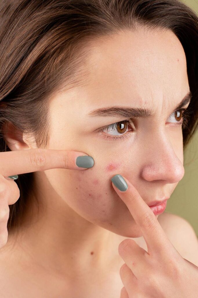 Clear Skin Ahead: The Role of Hypochlorous Acid Face Spray in Modern Skincare